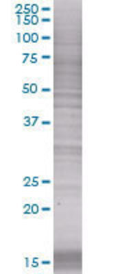 CSF2RA transfected lysate