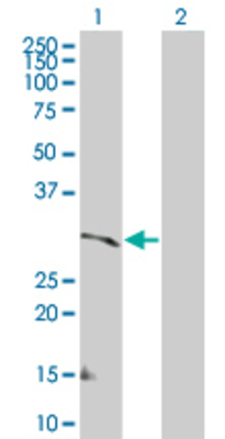 Lane 1: CSF2RA transfected lysate (46.2 KDa). Lane 2: Non-transfected lysate.