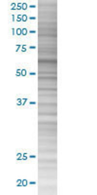 OXSR1 transfected lysate.