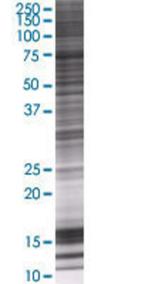 SRBD1 transfected lysate.