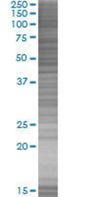 ZNF136 transfected lysate.