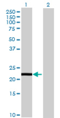 Lane 1: CALN1 transfected lysate (24.2 KDa) Lane 2: Non-transfected lysate.