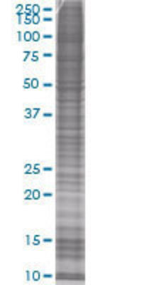 EXTL2 transfected lysate