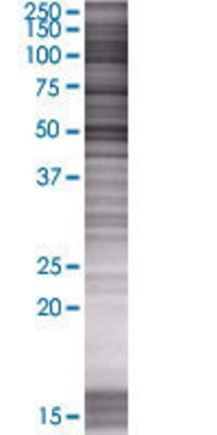 PRAME transfected lysate.