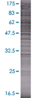 CALML3 transfected lysate.