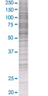 GGT1 transfected lysate.