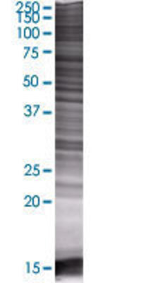 FGL2 transfected lysate.