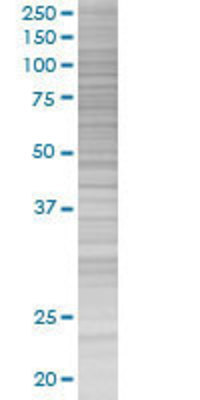 MCCC1 transfected lysate.