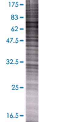 POR transfected lysate.