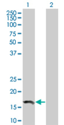 Lane 1: SIVA transfected lysate (19.36 KDa) Lane 2: Non-transfected lysate.