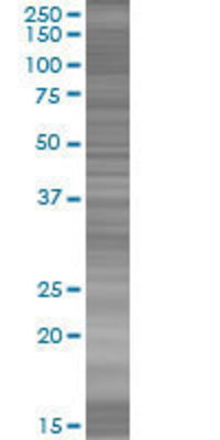 HSD17B2 transfected lysate.