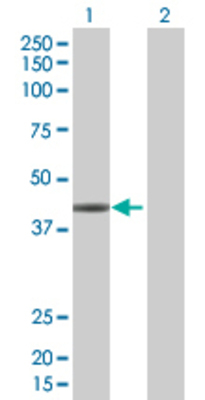 Lane 1: ANKRD1 transfected lysate (36.3 KDa) Lane 2: Non-transfected lysate.