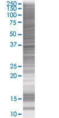 ANKRD1 transfected lysate.