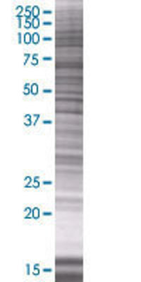 PPIL3 transfected lysate.