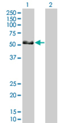 Lane 1: IRF6 transfected lysate (53 KDa) Lane 2: Non-transfected lysate.