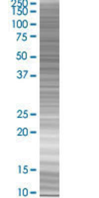SSBP2 transfected lysate.