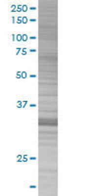 ING2 transfected lysate.