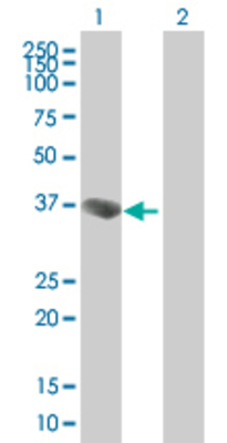 Lane 1: ING2 transfected lysate (32.8 KDa) Lane 2: Non-transfected lysate.