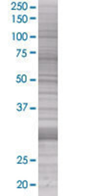 SNAI1 transfected lysate.
