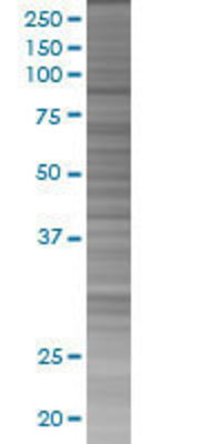 TGM1 transfected lysate.