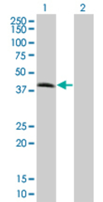 Lane 1: TMOD2 transfected lysate (38.72 KDa) Lane 2: Non-transfected lysate.