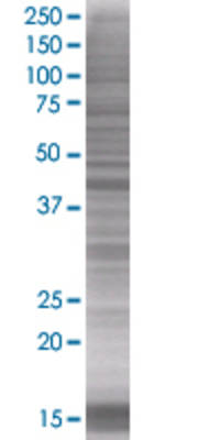 TMOD2 transfected lysate.