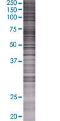 COX10 transfected lysate.