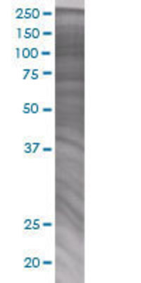 NME6 transfected lysate.