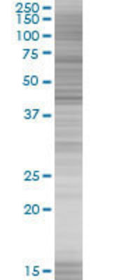 GTF2H4 transfected lysate.