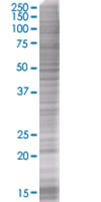 FTH1 transfected lysate
