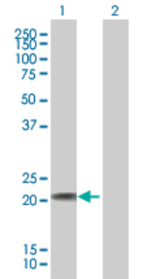Lane 1: FTH1 transfected lysate (21.2 KDa). Lane 2: Non-transfected lysate.