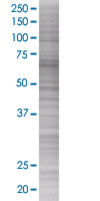 FEM1B transfected lysate