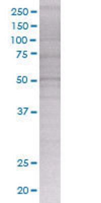 PPM1F transfected lysate.