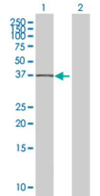 Lane 1: BNIPL transfected lysate (31 KDa) Lane 2: Non-transfected lysate.