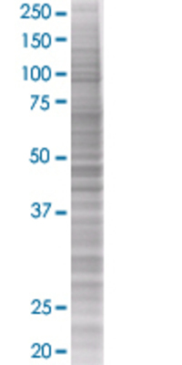 BCAT1 transfected lysate.