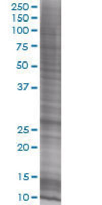 SSX2 transfected lysate