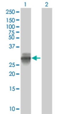 Lane 1: SSX2 transfected lysate (20.79 KDa). Lane 2: Non-transfected lysate.