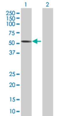 Lane 1: RAD23B transfected lysate (43.2 KDa) Lane 2: Non-transfected lysate.