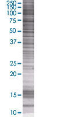 B4GALT4 transfected lysate.