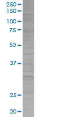 SNAP25 transfected lysate.
