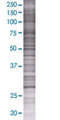 HSD17B3 transfected lysate.