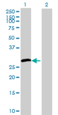 Lane 1: HSD17B3 transfected lysate (34.21 KDa) Lane 2: Non-transfected lysate.