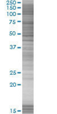 GTF2B transfected lysate.