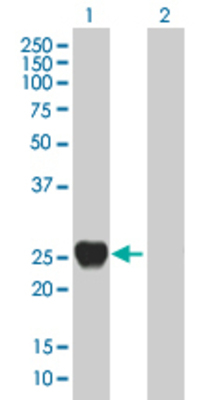Lane 1: RAB39 transfected lysate (23.98 KDa). Lane 2: Non-transfected lysate.