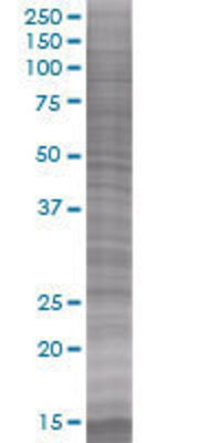 RAB39 transfected lysate