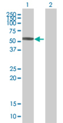 Lane 1: KRT8 transfected lysate (53.7 KDa) Lane 2: Non-transfected lysate.