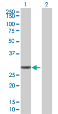 Lane 1: KHK transfected lysate (32.7 KDa) Lane 2: Non-transfected lysate.
