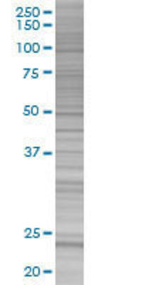 RCV1 transfected lysate.