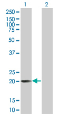 Lane 1: RCV1 transfected lysate (22.11 KDa) Lane 2: Non-transfected lysate.