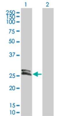 Lane 1: DKK4 transfected lysate (24.9 KDa) Lane 2: Non-transfected lysate.